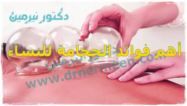 أهم فوائد الحجامة للنساء