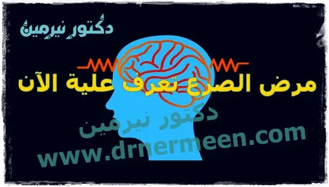 مرض الصرع تعرف علية الآن