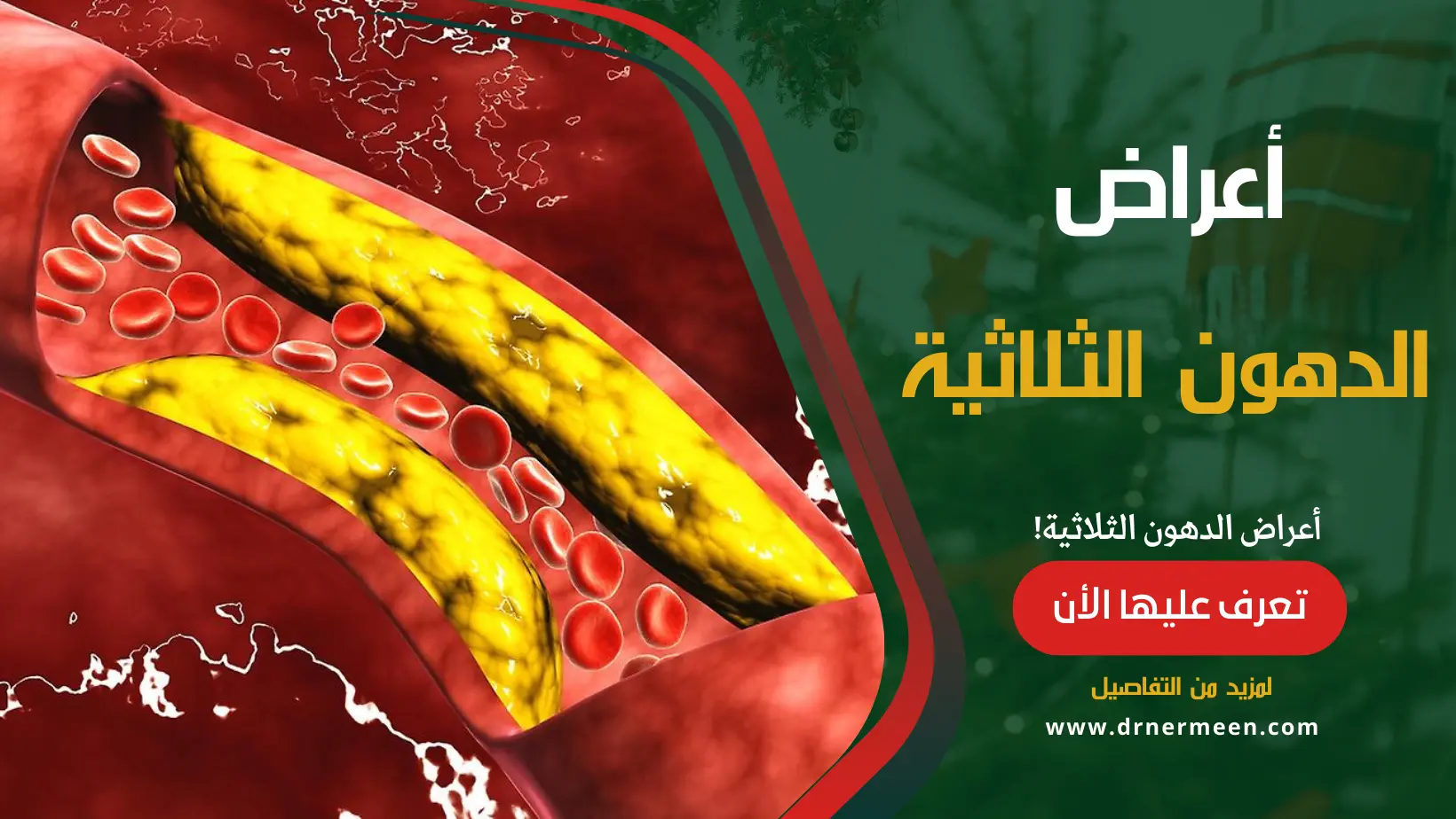 أعراض الدهون الثلاثية في الجسم