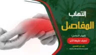 التهاب المفاصل أعراضة، أسبابة، علاجة