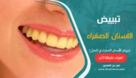 تبييض الأسنان الصفراء في المنزل