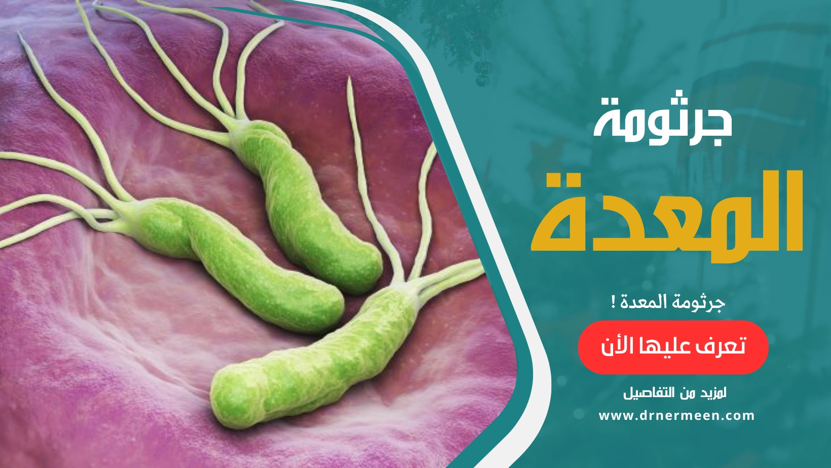 جرثومة المعدة الأعراض والعلاج Helicobacter pylori