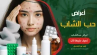 حب الشباب Acne: علاماته، أسبابه، علاجه