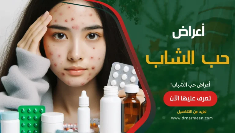حب الشباب Acne علاماته، أسبابه، علاجه