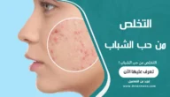 التخلص من حب الشباب
