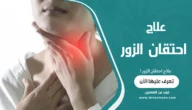 علاج احتقان الزور