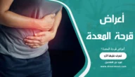 أعراض قرحة المعدة