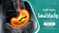 جرثومة المعدة وأعراضها