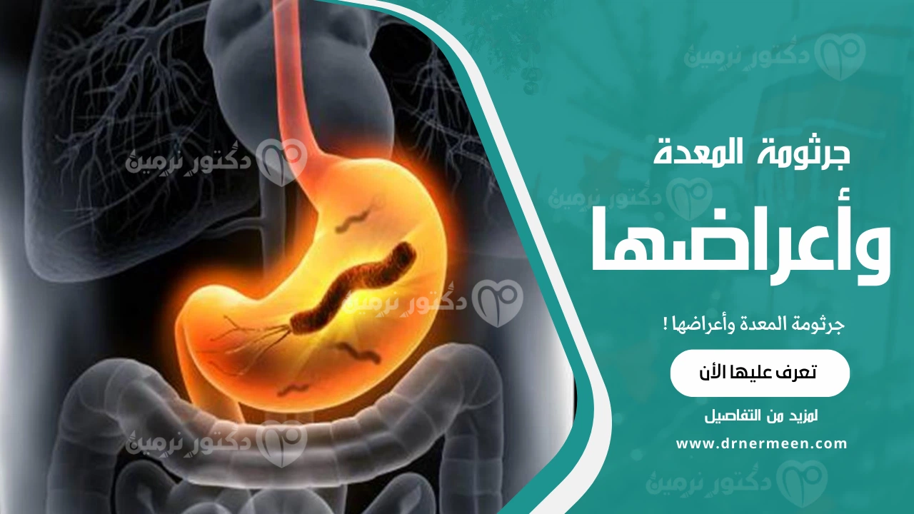 جرثومة المعدة وأعراضها