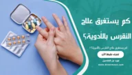 كم يستغرق علاج النقرس بالأدوية؟
