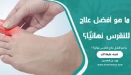 ما هو أفضل علاج للنقرس نهائيًا؟
