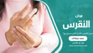 مرض النقرس: التغذية الغير مسموح بها