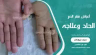 أعراض فقر الدم الحاد وعلاجه