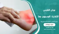 مرض النقرس: التغذية المسموح بها