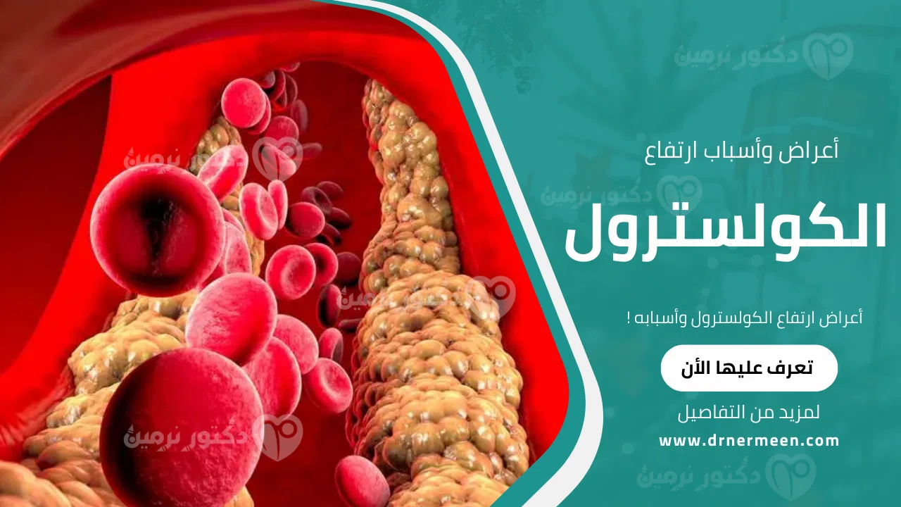 أعراض ارتفاع الكولسترول وأسبابه