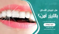 هل تبييض الأسنان بالليزر آمن؟