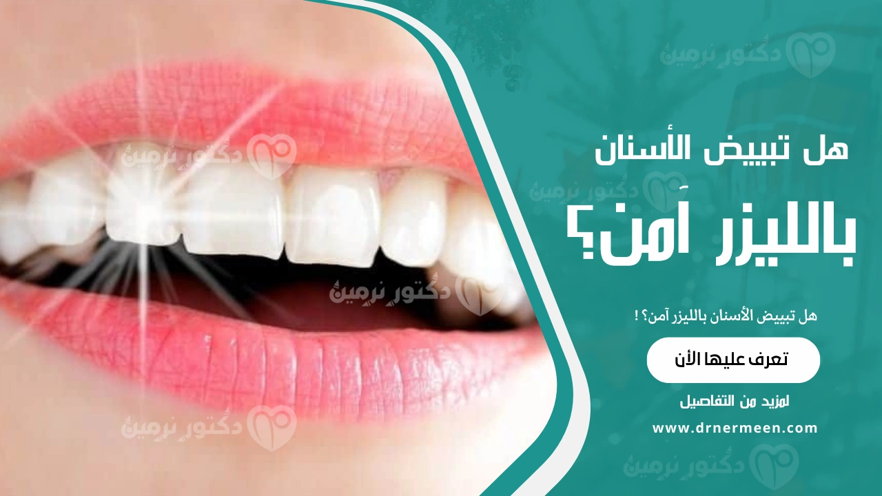 هل تبييض الأسنان بالليزر آمن؟