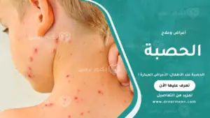 الحصبة عند الأطفال وأعراضها المبكرة وطرق العدوى والوقاية