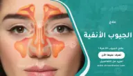 علاج الجيوب الأنفية: الطرق الطبية الفعالة ومتى يحتاج المريض للطبيب