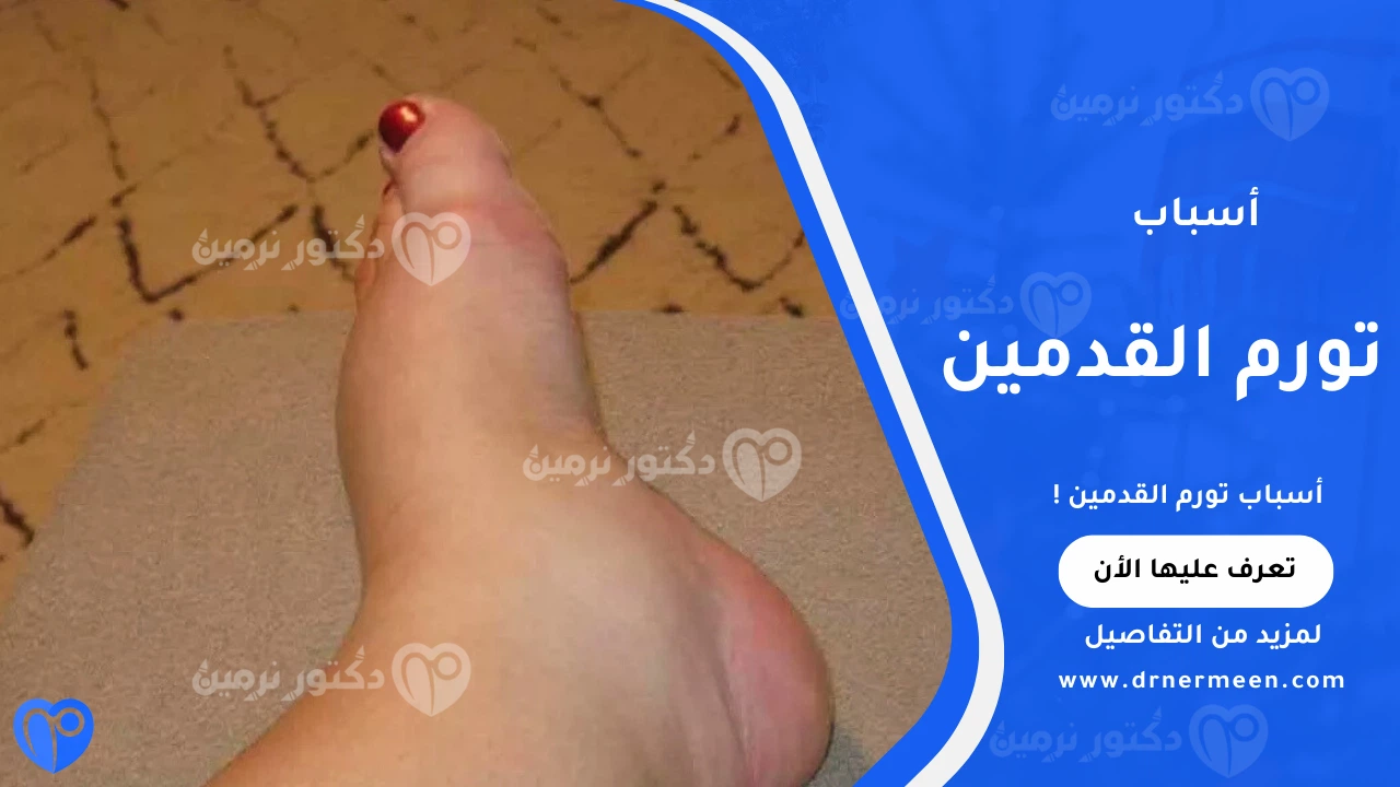 أسباب تورم القدمين وأهم العوامل الصحية المرتبطة به