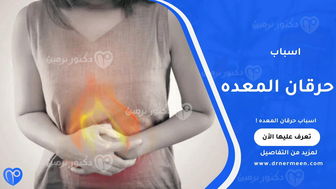 اسباب حرقان المعده الشائعة وتأثيرها على صحة الجهاز الهضمي