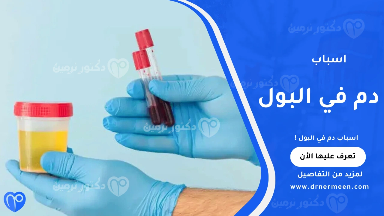 اسباب دم في البول الشائعة ودلالاته الصحية
