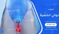 اسباب دوالي الخصية وأهم العلامات المبكرة