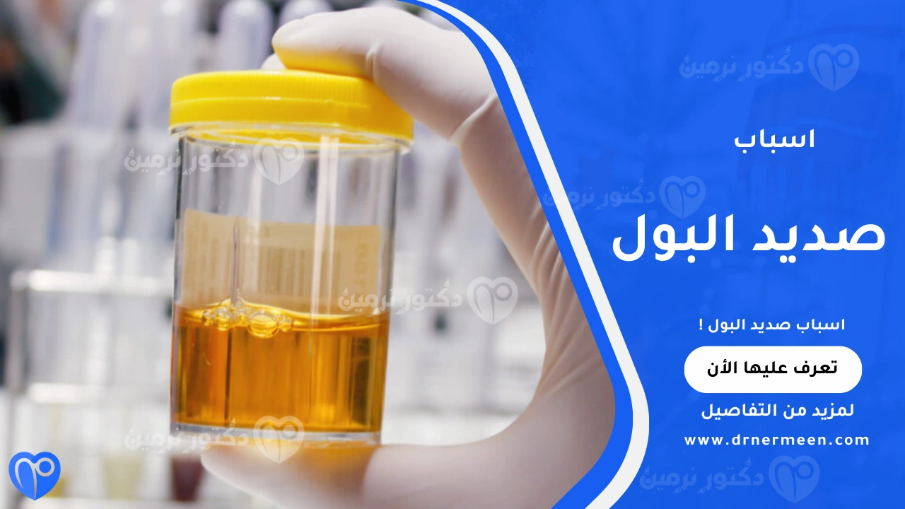 اسباب صديد البول الشائعة وتأثيرها على الجهاز البولي