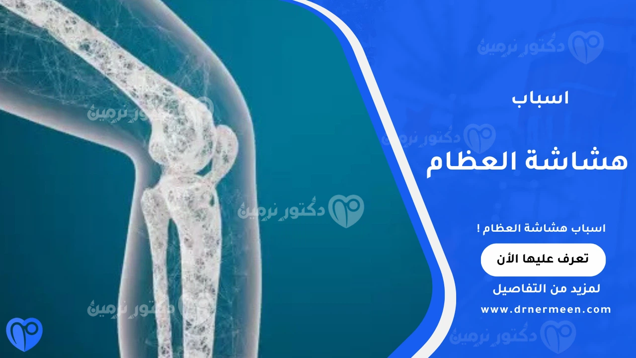 اسباب هشاشة العظام الشائعة وتأثيرها على صحة العظام