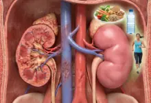 تأثير السكري على الكلى وكيفية الوقاية وأهم طرق حماية الكلى من مضاعفات السكري