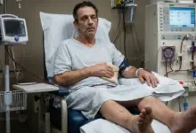 أمراض الكلى عند الرجال وأهم الحالات التي تؤثر على وظائف الكلى