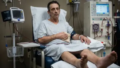 أمراض الكلى عند الرجال وأهم الحالات التي تؤثر على وظائف الكلى